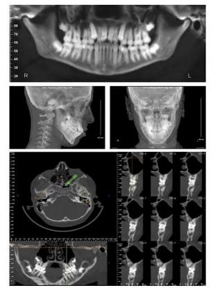 Picture of 03/11/2027: The Good, the Bad, and the Incidental: CBCT Cases Reviewed