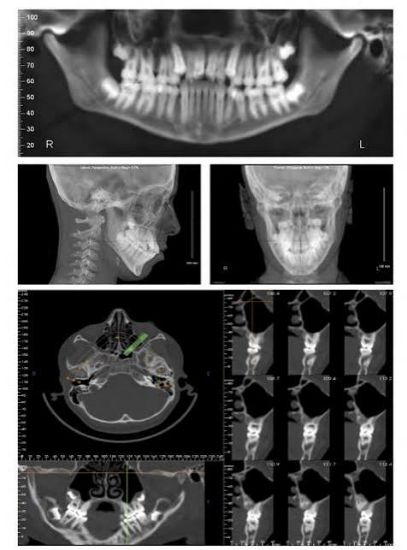 Picture of 03/11/2027: The Good, the Bad, and the Incidental: CBCT Cases Reviewed
